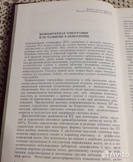 Компьютерная томография мозга, Верещагин