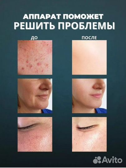 Аппарат для чистки лица