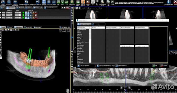 PlastyCad v.1.7&3Diagnosys v4.2