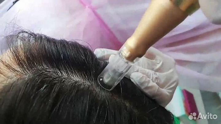 Hydrafacial,фракционая меза лица,тела,головы,рук