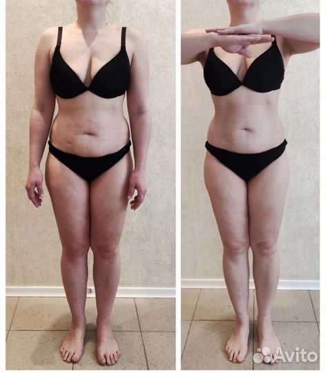 Мадеротерапия,тела и лица. Снижение веса и объёма