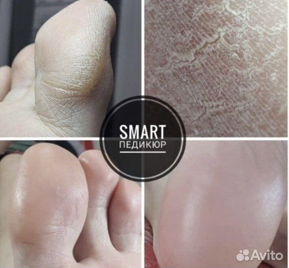 Смарт педикюр