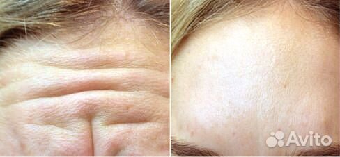 Врач - косметолог