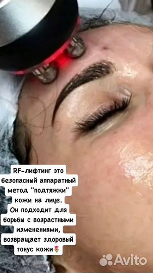 Косметолог, RF-лифтинг, УЗ чистка,мезотерапия