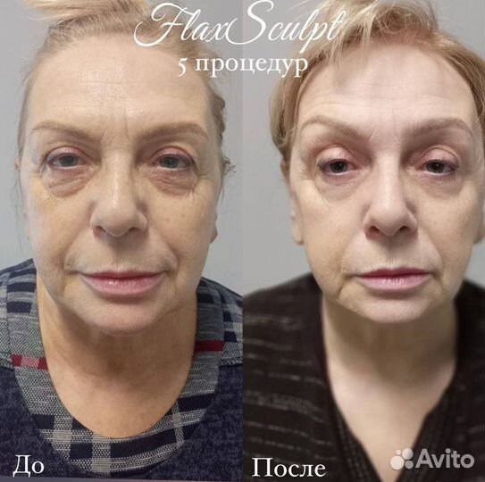Услуги косметолога