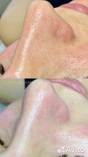 Услуги косметолога,хаджам