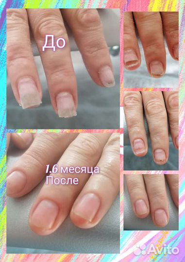 Медицинский педикюр (подолог)