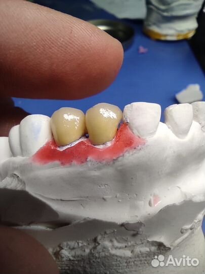 Зуботехнические услуги