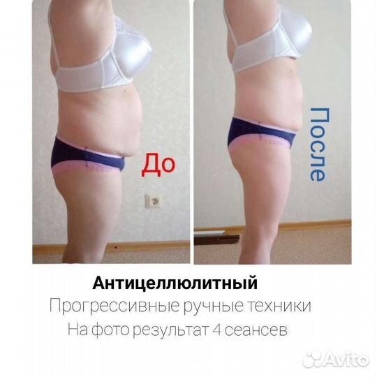 Массаж спины, Ног, Рук, Шеи, Лица. Убрать Боль