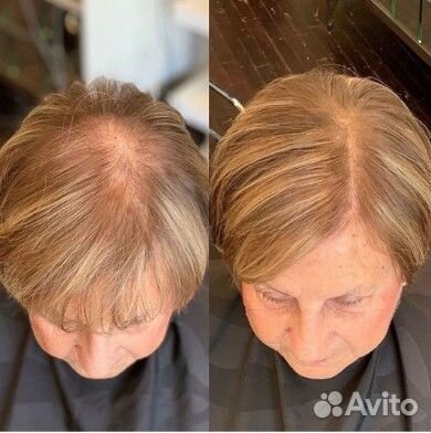 Загущение волос наращиванием