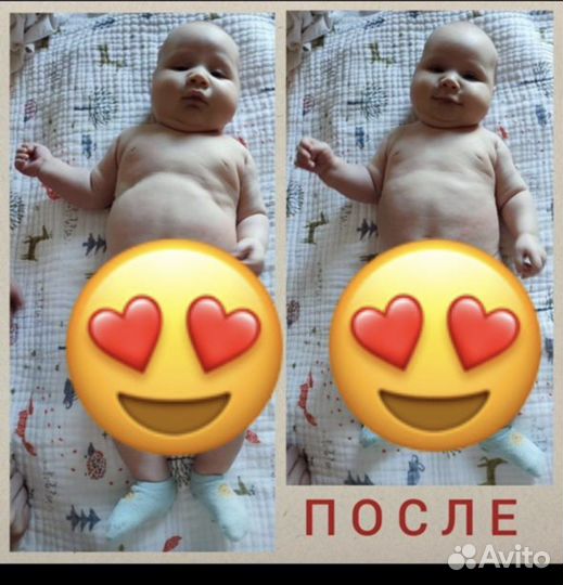 Обучение курсы массажа