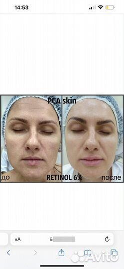 Пилинг mediderma ретиноловый