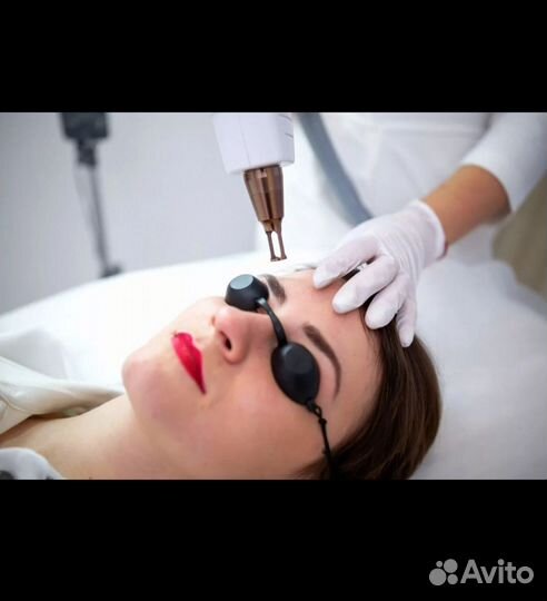 Лазерное удаление татуажа, тату, карбоновый пилинг