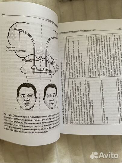 Справочник по нервным болезням мед литература