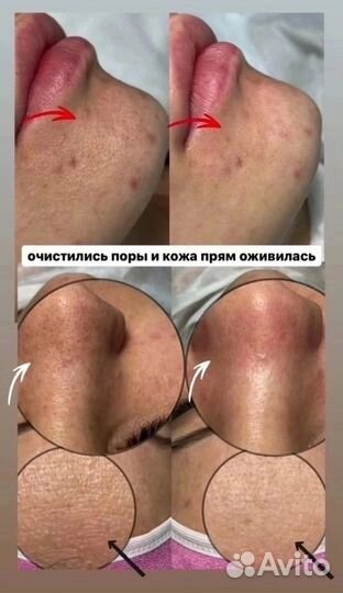 Энзимная пудра