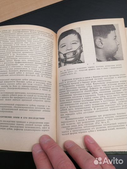 Профилактика зубочелюстных аномалия. хорошилкина