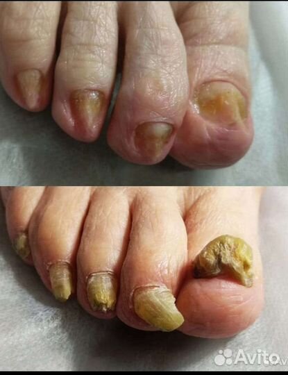 Педикюр Подолог Ленинский проспект