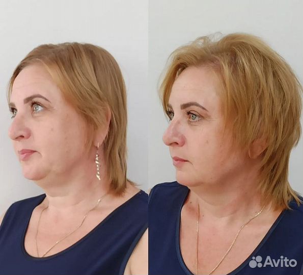 Прикорневой объём