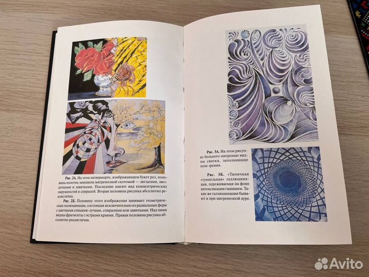 «Мигрень» Сакс Оливер, твердый переплёт