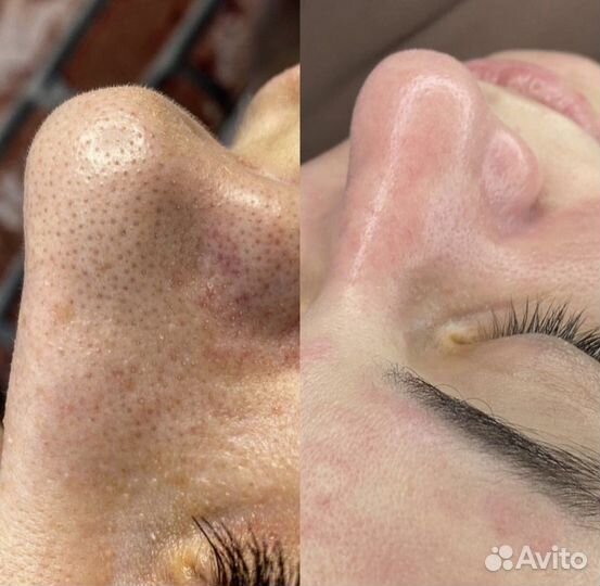 Обучение на косметолога