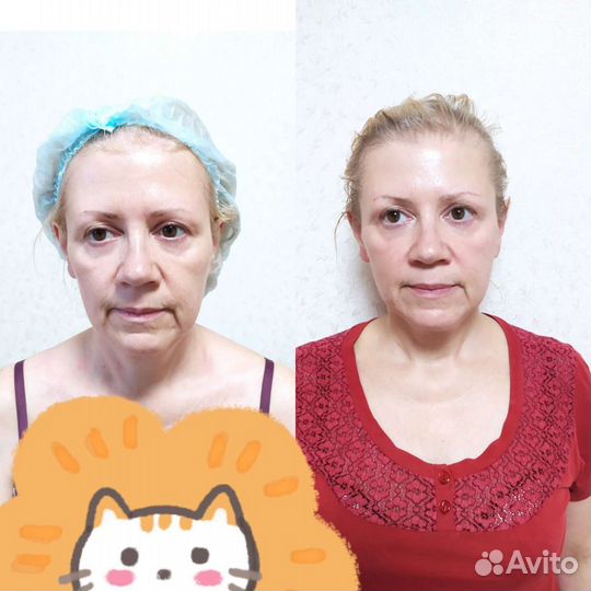 Массаж лица / Массаж ШВЗ /Массаж спины