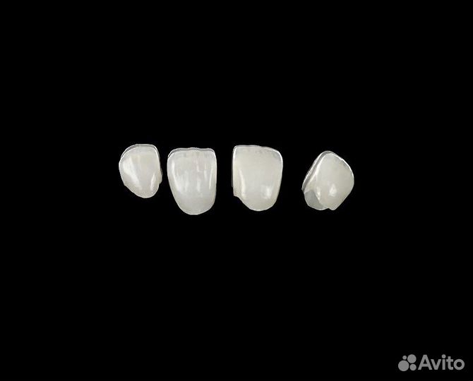 Изготовление эстетических коронок