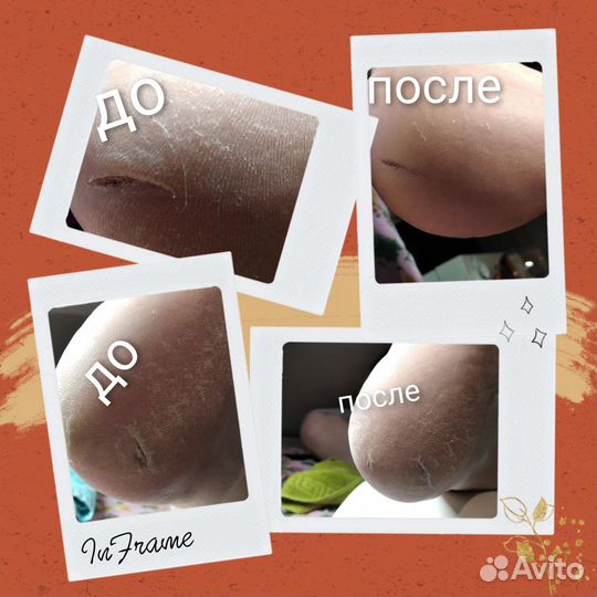 Маникюр с покрытием гель-лаком