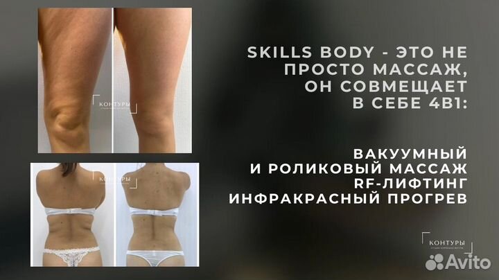 LPG аппаратный массаж