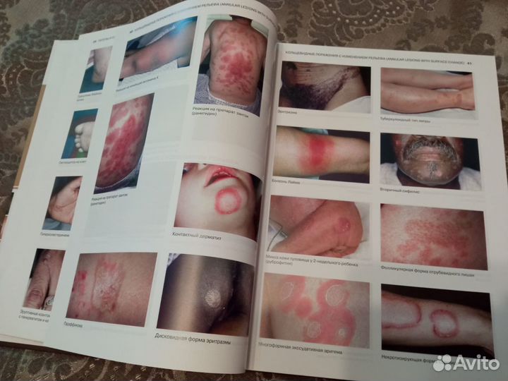 Атлас для врачей дерматовенерологов