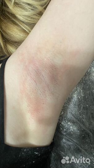 Шугаринг на дому