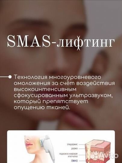 Модель на SMAS лифтинг