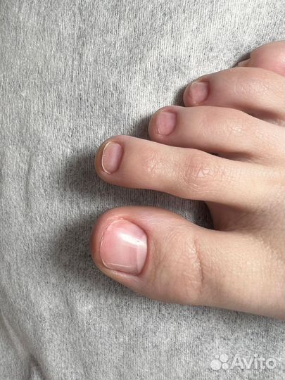 Педикюр на дому