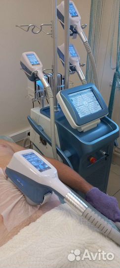 Криолиполиз/Локальное удаление жира