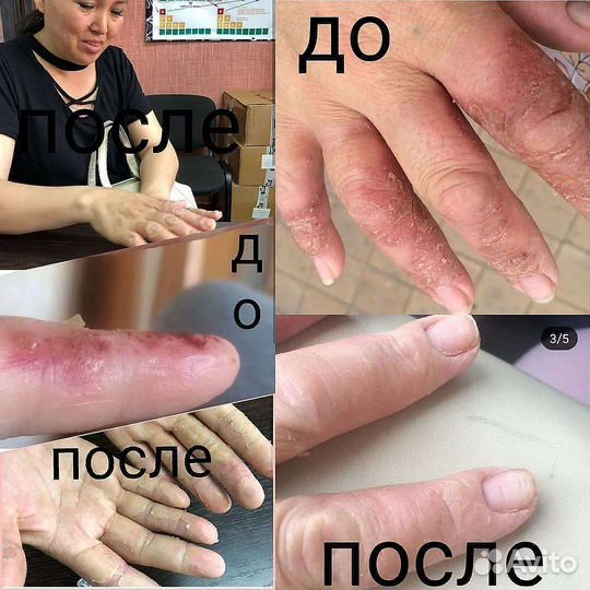 Бальзам камкор