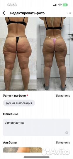 Ручная липопластика