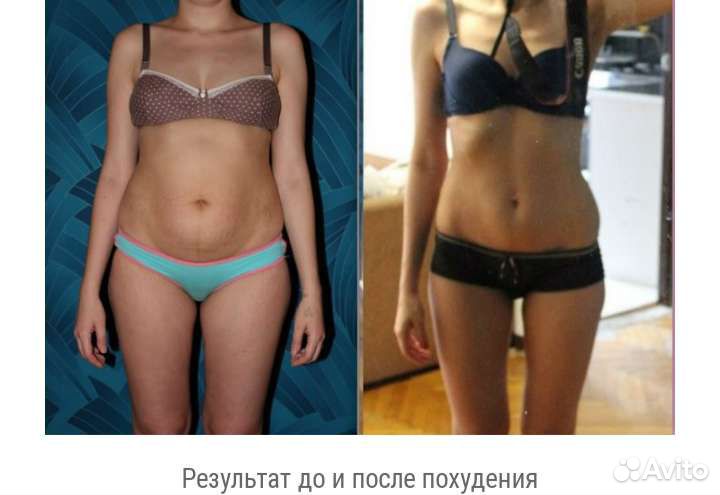 Моменталиное сжигание жиров