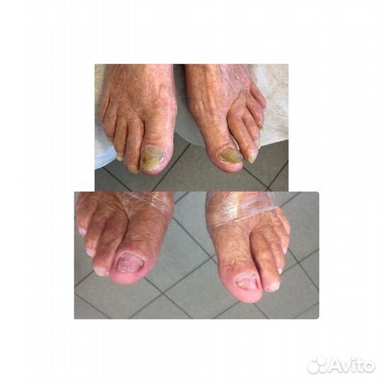 Педикюр С основами подологии