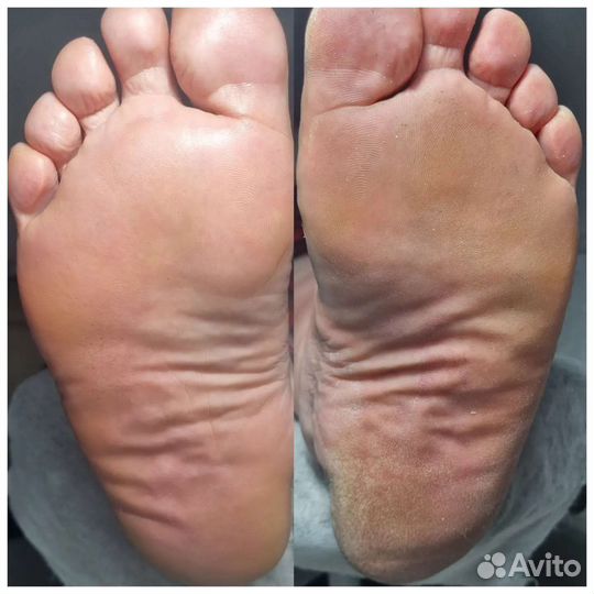 Маникюр, педикюр