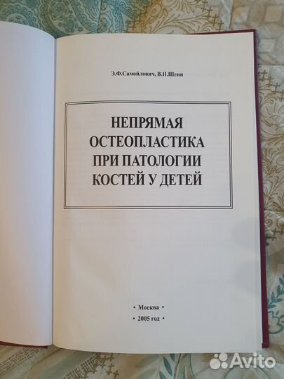 Э.Ф. Самойлович Непрямая остеопластика у детей