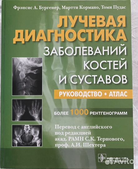 Лучевая диагностика заболеваний костей и суставов