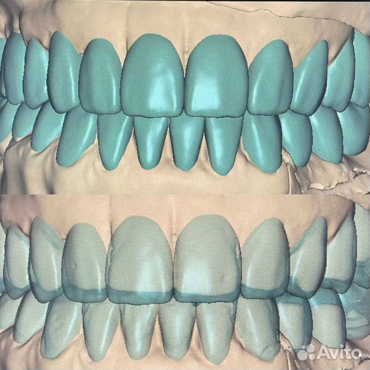 Оператор Зубной техник