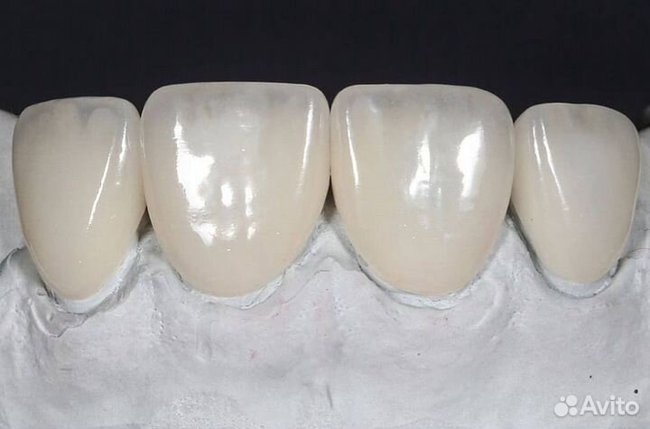 Изготовление безметалловых коронок, виниров е-max