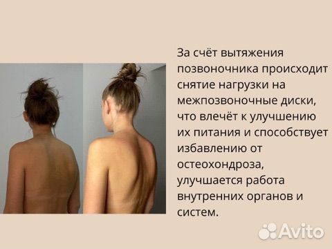 Массаж при остеохондрозе/ исправление осанки