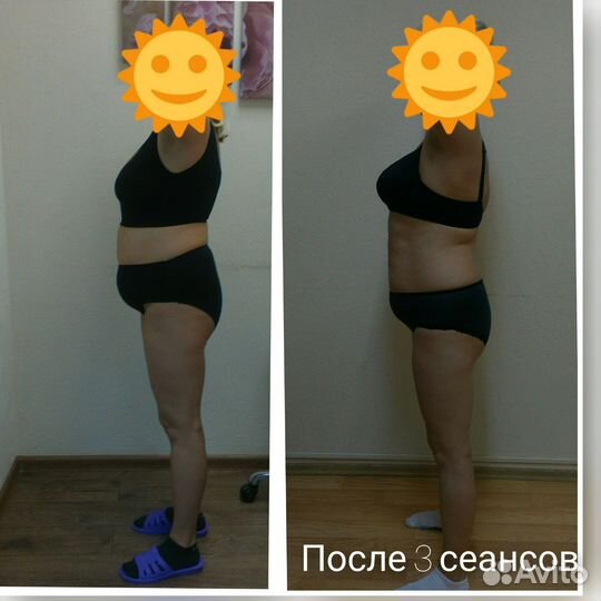 Висцеропластика и правки тела