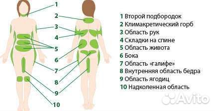 Криолиполиз процедура