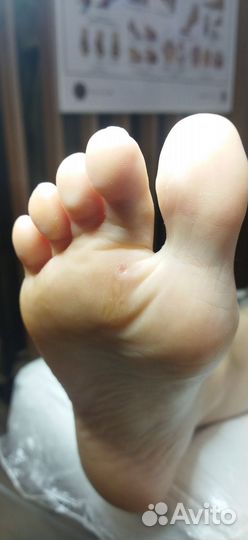 Педикюр лечебный, подолог, выезд на дом