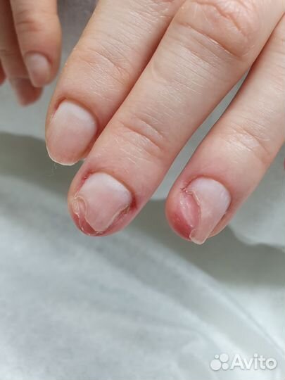 Педикюр, подолог Колтуши, Всеволожский район