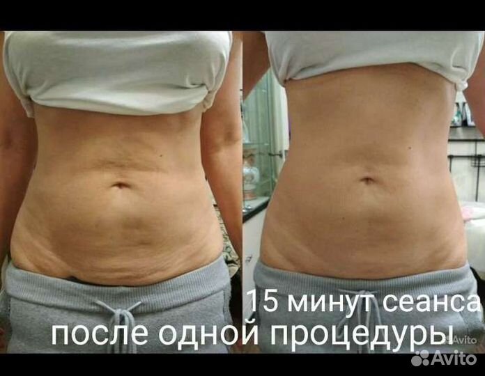 Антицеллюлитный массаж и коррекция фигуры