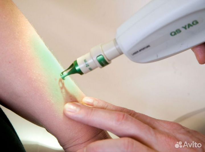 Купите готовый бизнес лазерной эпиляции