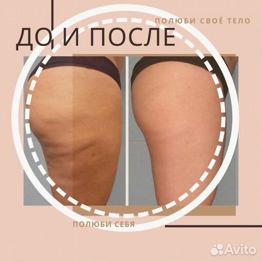 Массаж LPG Ручной Шугаринг Маникюр